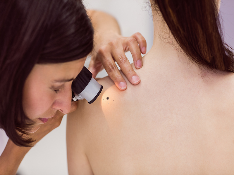 Dermatologist examining skin of patient