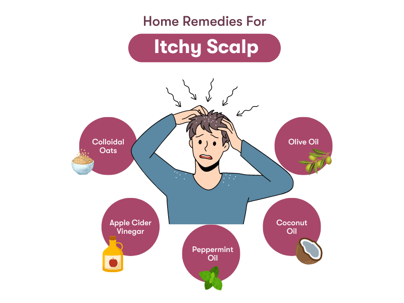 home remedies for itchy scalps 