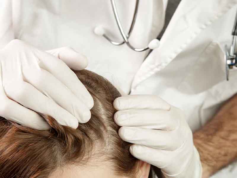 Diagnosis of scalp conditions