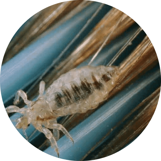 Head lice