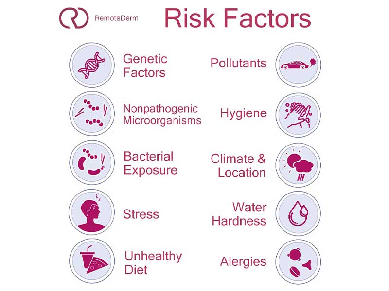 risk factors of eczema