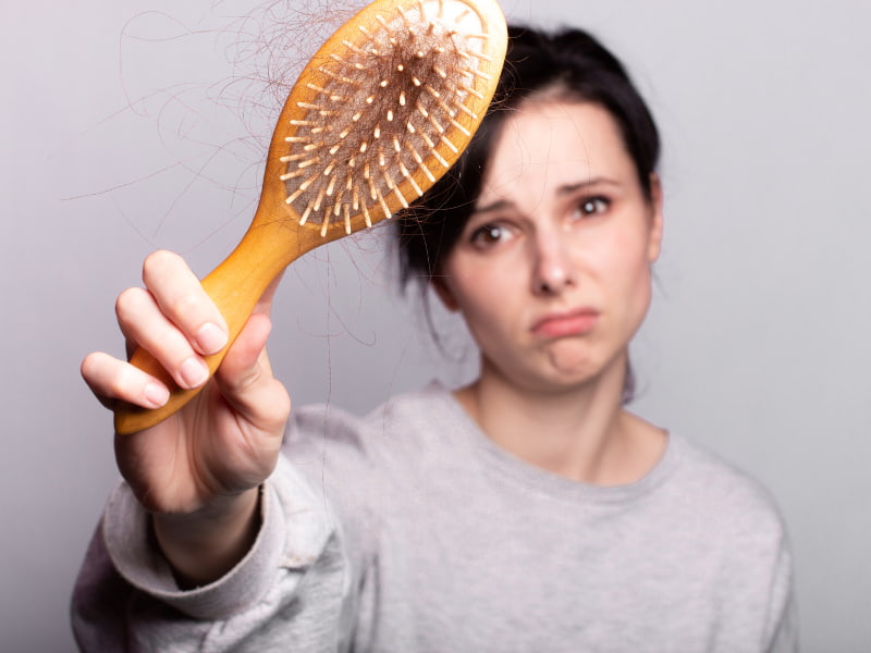 Woman with severe hair shedding