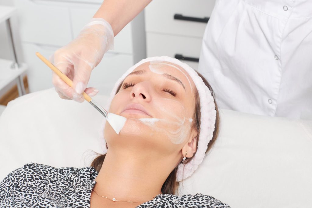 Chemical peels can improve whiteheads